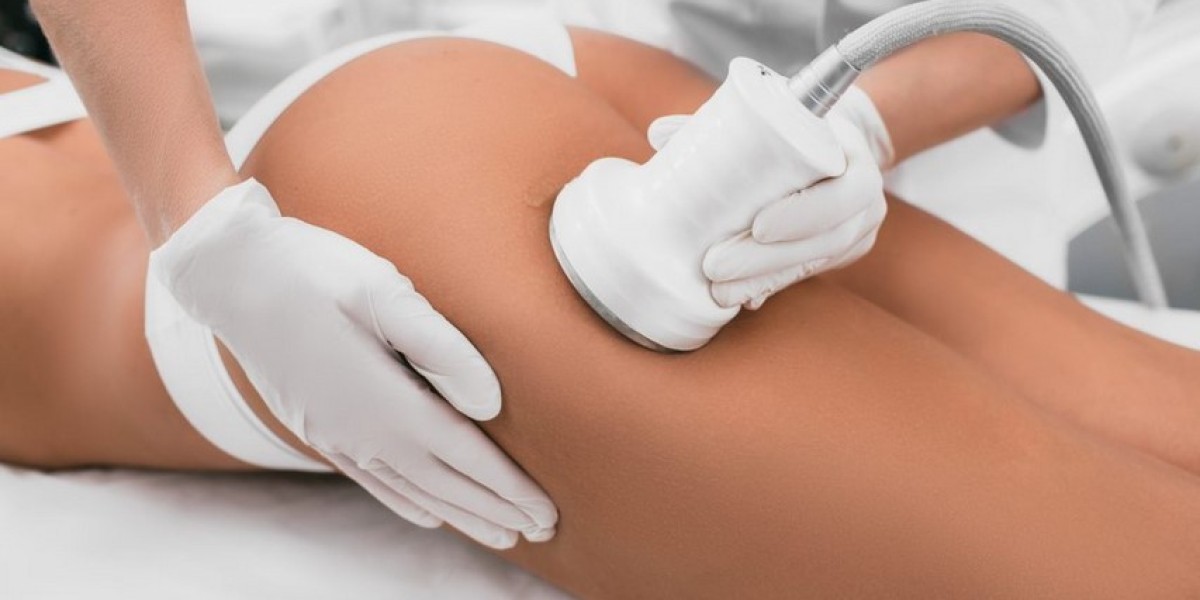 Ultrasonic Cavitation Treatments: Does Fat Reduction Without Surgery Really Work?