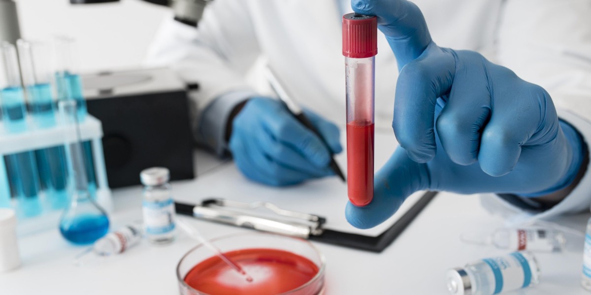 Affordable & Reliable Blood Test Bangalore – Home Sample Collection Available