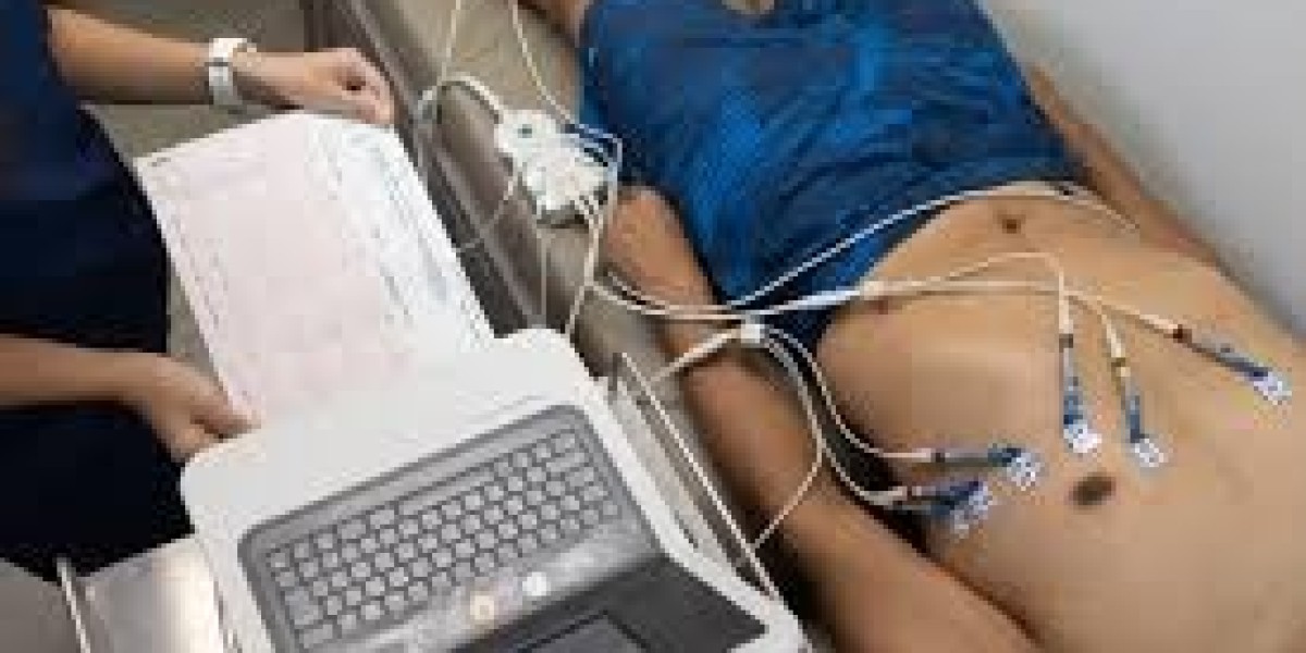 Affordable ECG Test Price in Bangalore | Best Diagnostic Care