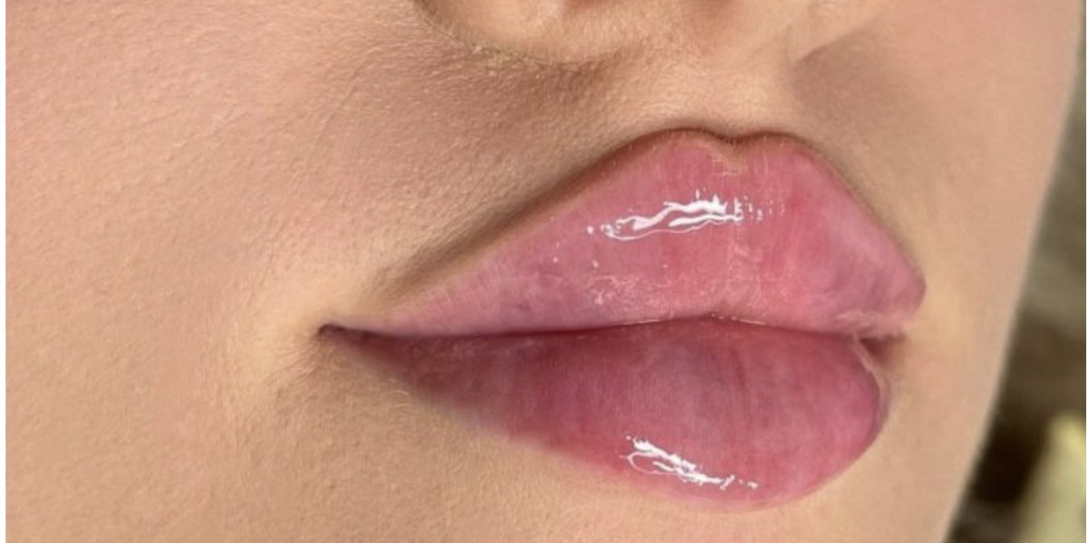 Sexy Lips – You Can Have Them Too