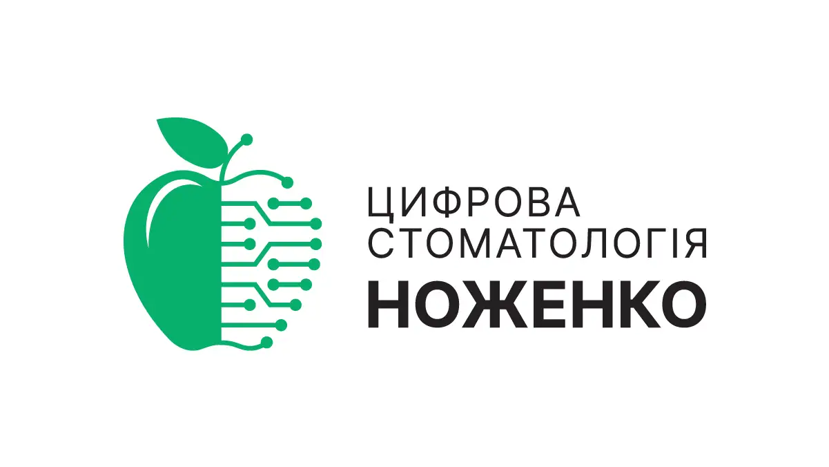 Відбілювання зубів – Професійна гігієна в Києві | Цифрова Стоматологія Ноженко