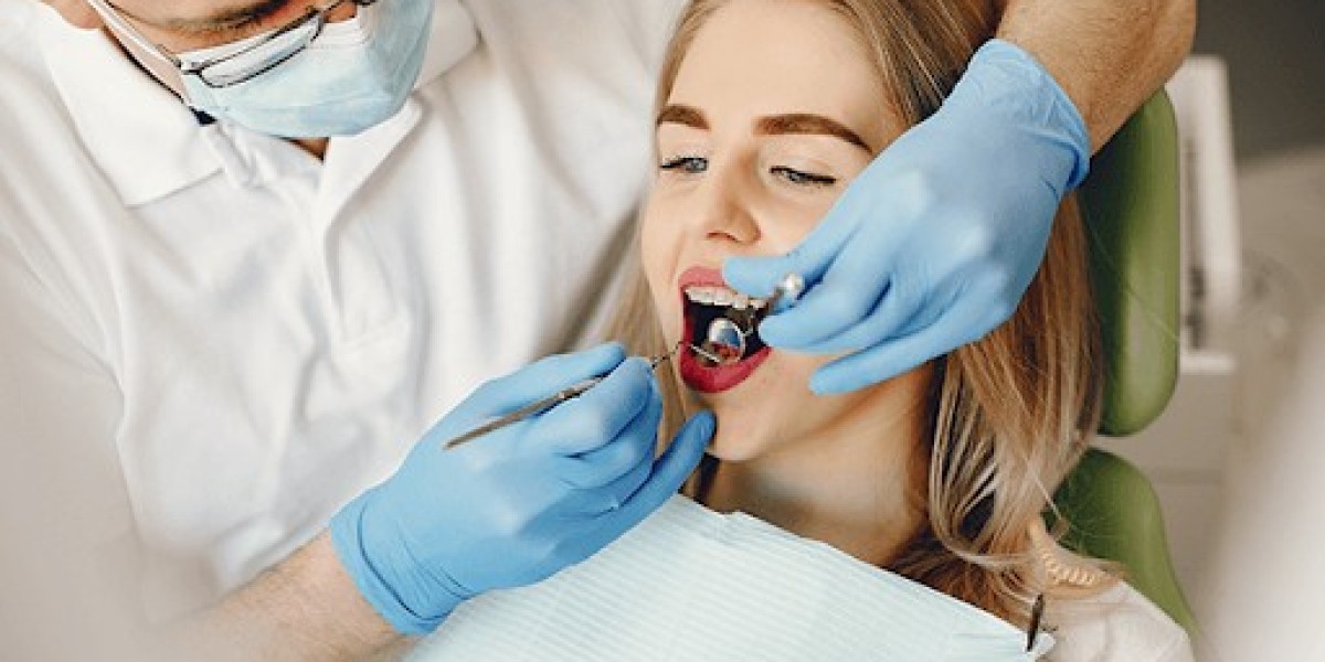 Porcelain Veneers in Arlington: Everything You Need to Know