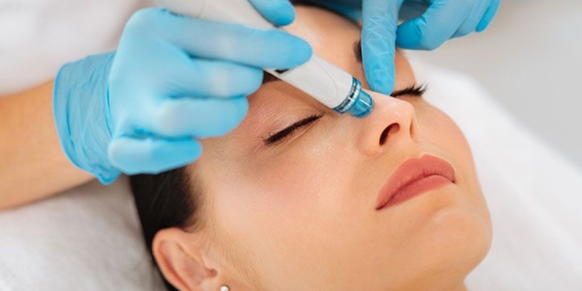 Do Hydrafacials Help With Acne Scars?