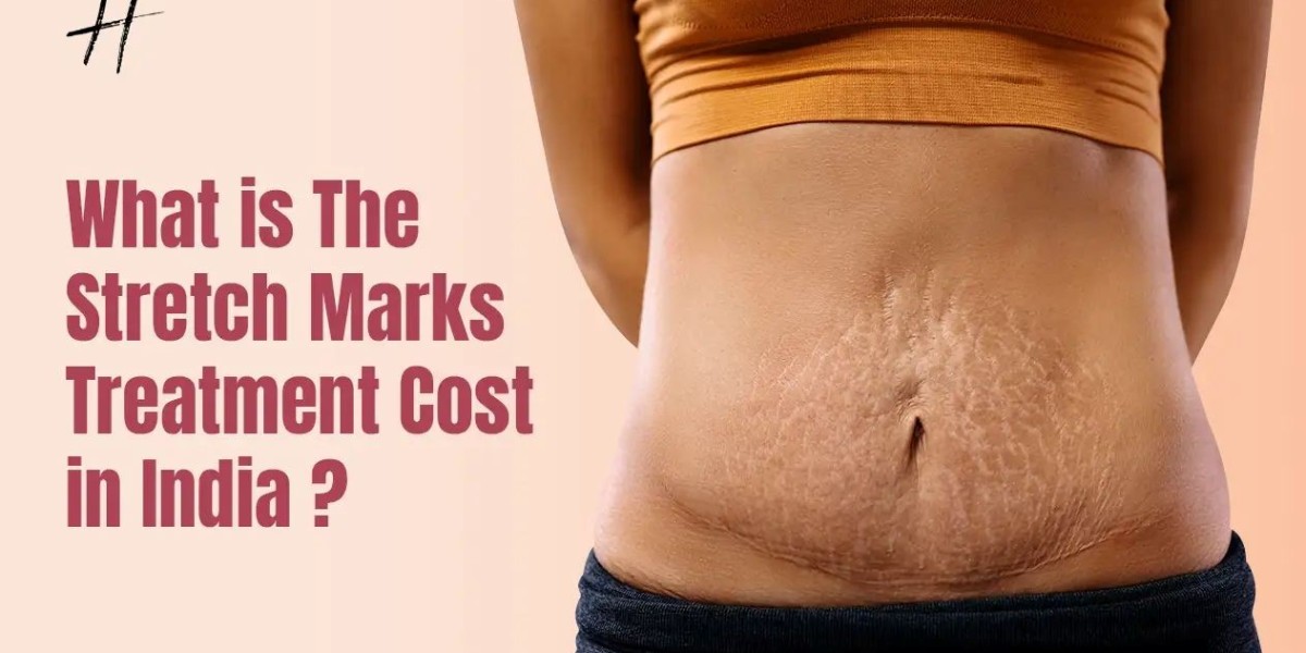 Stretch Mark Removal Treatment in Delhi at Handa Aesthetics