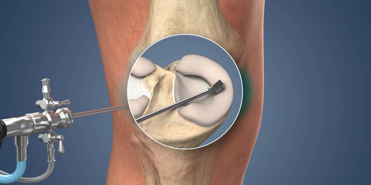 Knee Arthroscopy in Jaipur: A Complete Guide to Minimally Invasive Knee Surgery