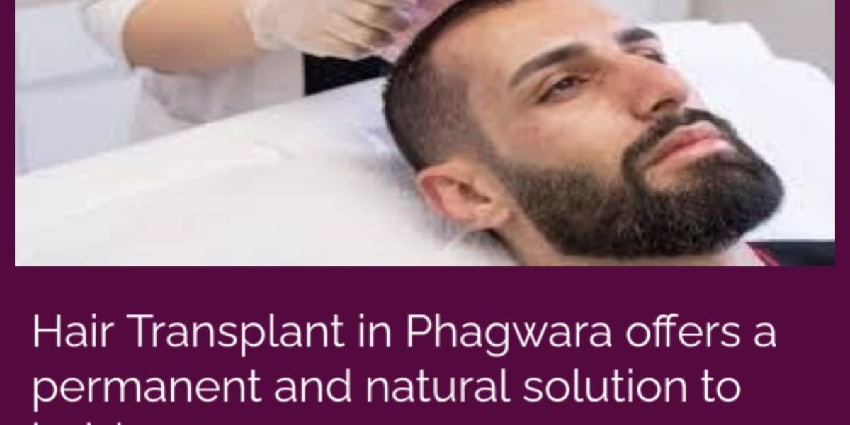 Natural-Looking Hair Transplant in Phagwara