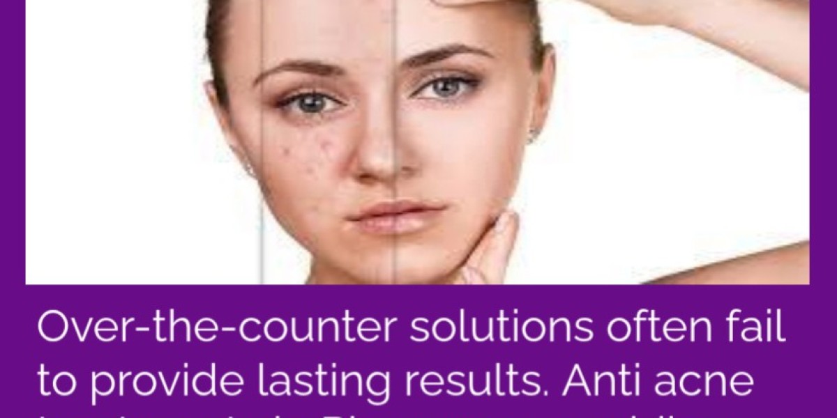 Clearer Skin Starts with Expert Anti-Acne Treatments in Phagwara