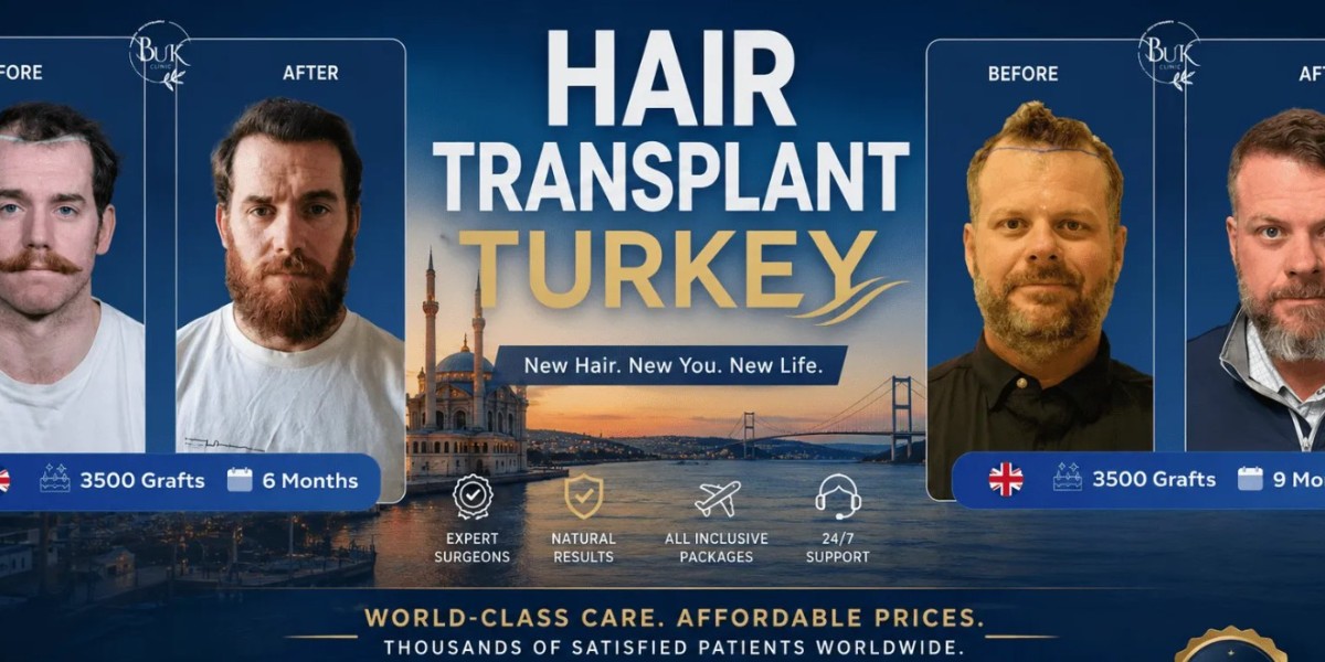 Hair Transplant Turkey: Understanding Modern Solutions for Thinning Hair
